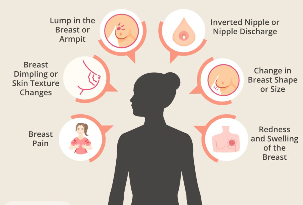 Infographic showing common breast cancer symptoms including breast lump, nipple discharge, breast dimpling, shape or size changes, redness, swelling, breast pain, and inverted nipple.